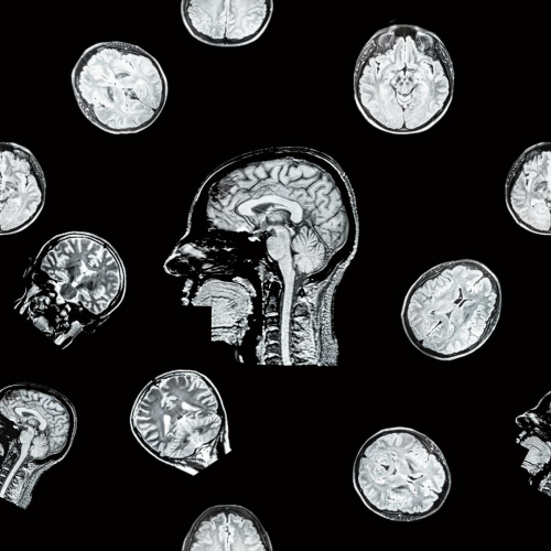 Department of Psychological Research Methods